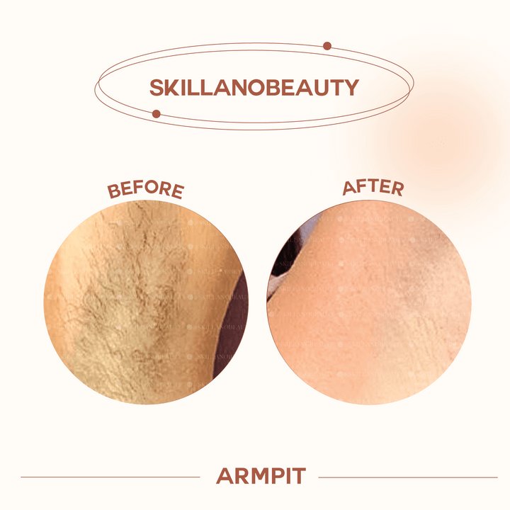 Skillano User's Review Armpit 1