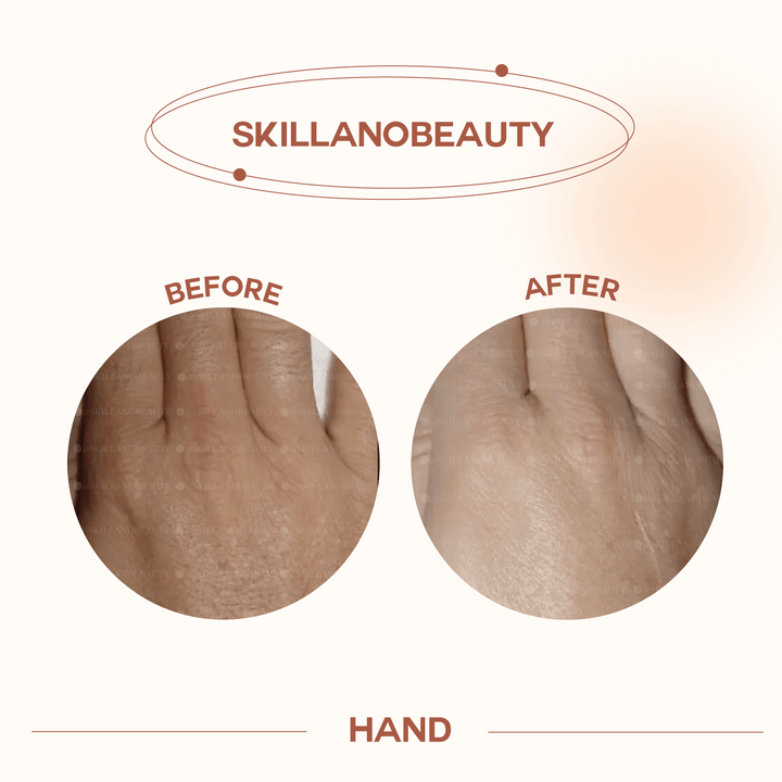 Skillano User Review Hand 1