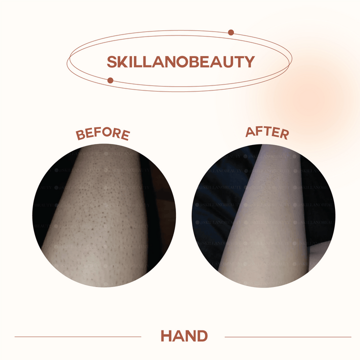 Skillano User Review Hand 2 