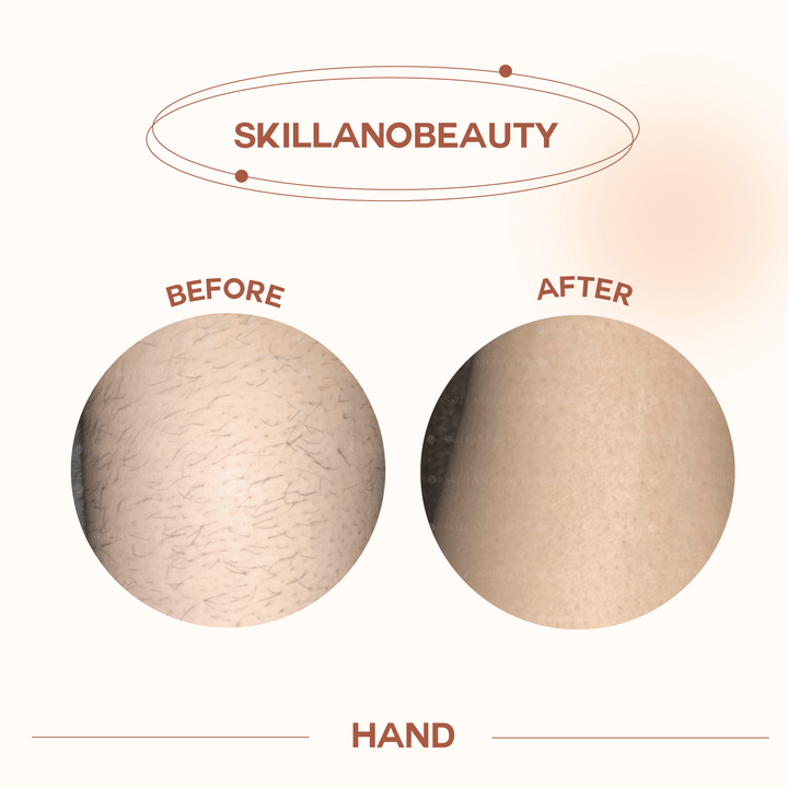 Skillano User Review Hand 3
