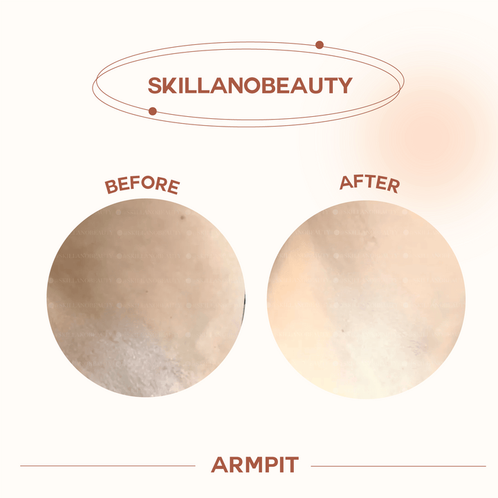 Skillano User Review Armpit 2