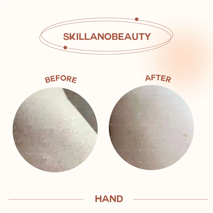 Skillano User Review Hand 4