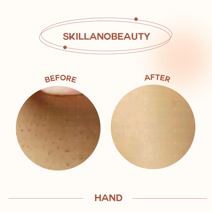 Skillano User Review Hand 5
